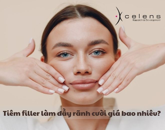 Tiêm filler làm đầy rãnh cười giá bao nhiêu?
