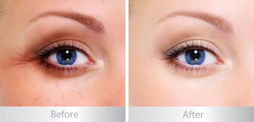 Kem trị bọng mắt, thâm quầng mắt Obagi ELASTIderm Eye Treatment Cream 15g – Giữ gìn đôi mắt sáng ngời tinh anh